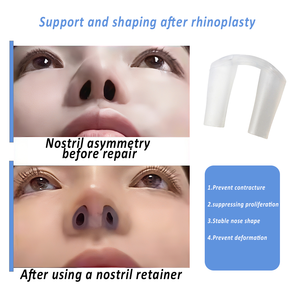 อุปกรณ์รัดจมูกสำหรับการฟื้นฟูห - Anti Snore Contour Pillow บทวิจารณ์และราคา